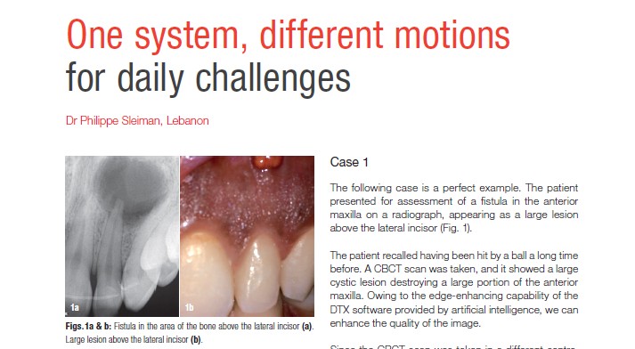 One system, different motions for daily challenges